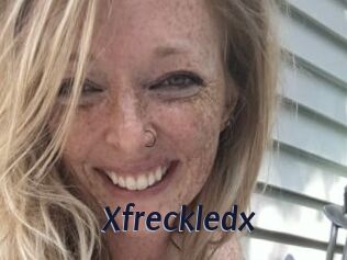 Xfreckledx